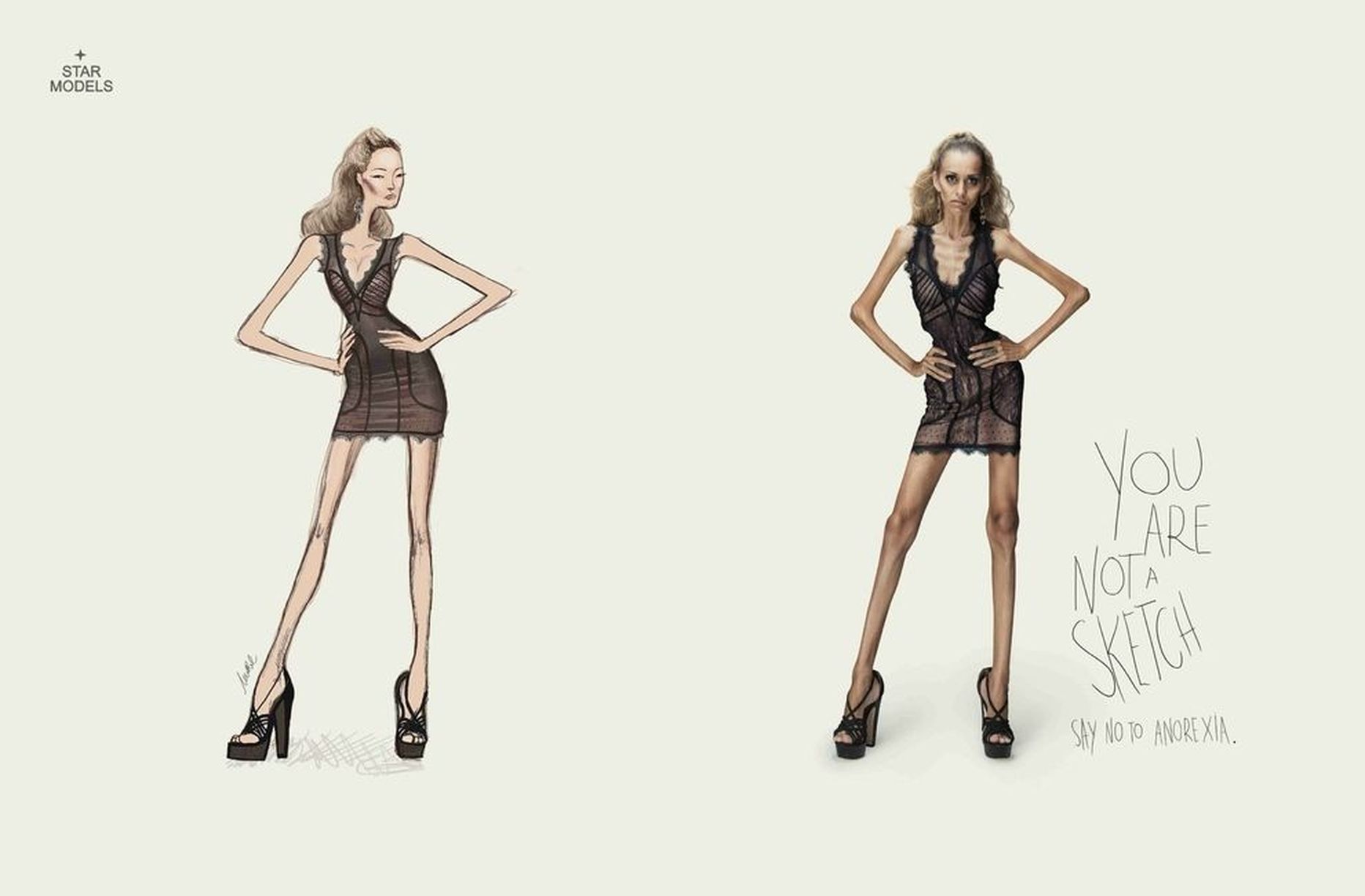 Pilt on illustreeriv ja kujutab anoreksiast teavitava hoiatuskampaaniat Star Modelsilt. Ekstreemselt «tervislik» toitumine on täpselt sama tappev!