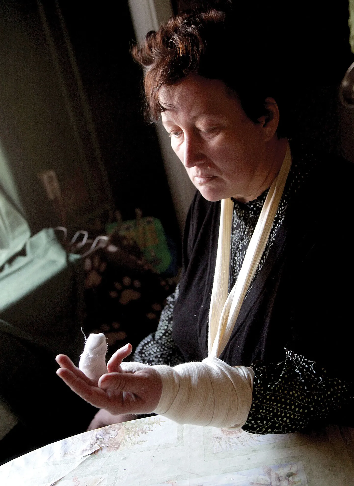 Tartu linnaliinibussis kukkunud Piret Reiljan näitab murdunud sõrme, mis peab nüüd mitu kuud lahases olema. Naine nõuab juhtunu pärast bussifirmalt hüvitist.