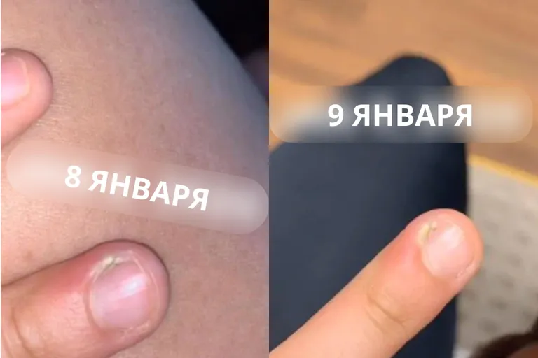 Ногти пострадавшей Лорен