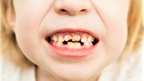PEALTNÄGIJA ⟩ Hambaarsti juures käigud muutusid õudusunenäoks: Ma ei tea ühtegi teist arsti, kellel oleks nii palju ravivigasid