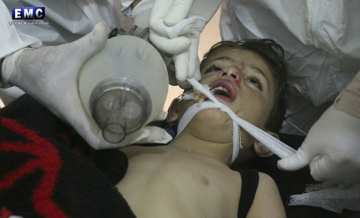 Süüria arstid üleeilses rünnakus viga saanud poissi ravimas.