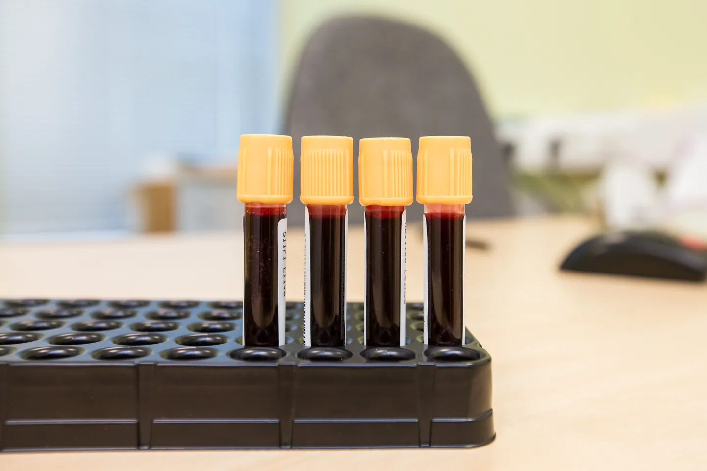 Synlabis tehakse test oomega-3 rasvhapete tasakaalu mõõtmiseks veeniverest.