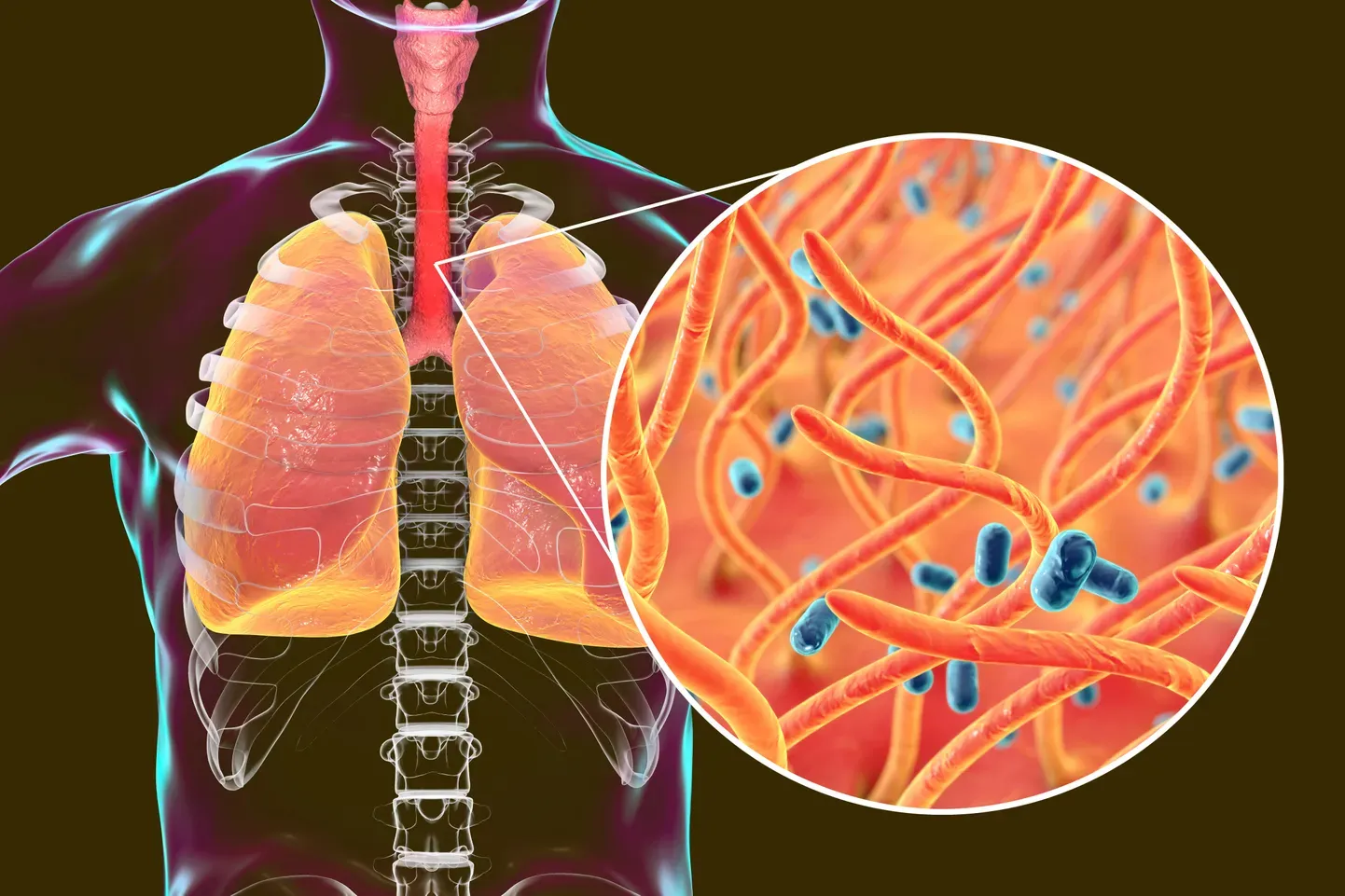 Возбудителем коклюша является бакткерия Bordetella pertussis. Иллюстративное фото.