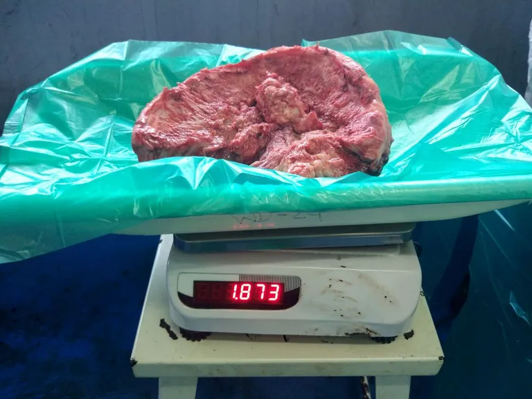Eemaldatud ajukasvaja kaalus 1,8 kilogrammi.
