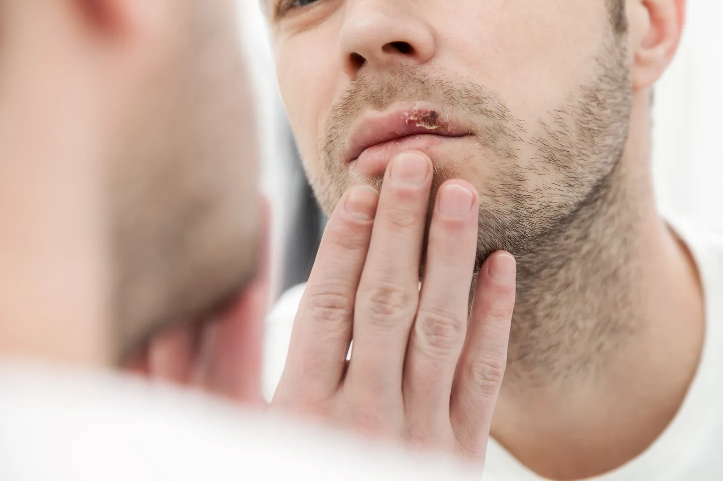 Herpesviiruse olemasolul organismis leiti suurem arv südameartereid kahjustavaid rakke.