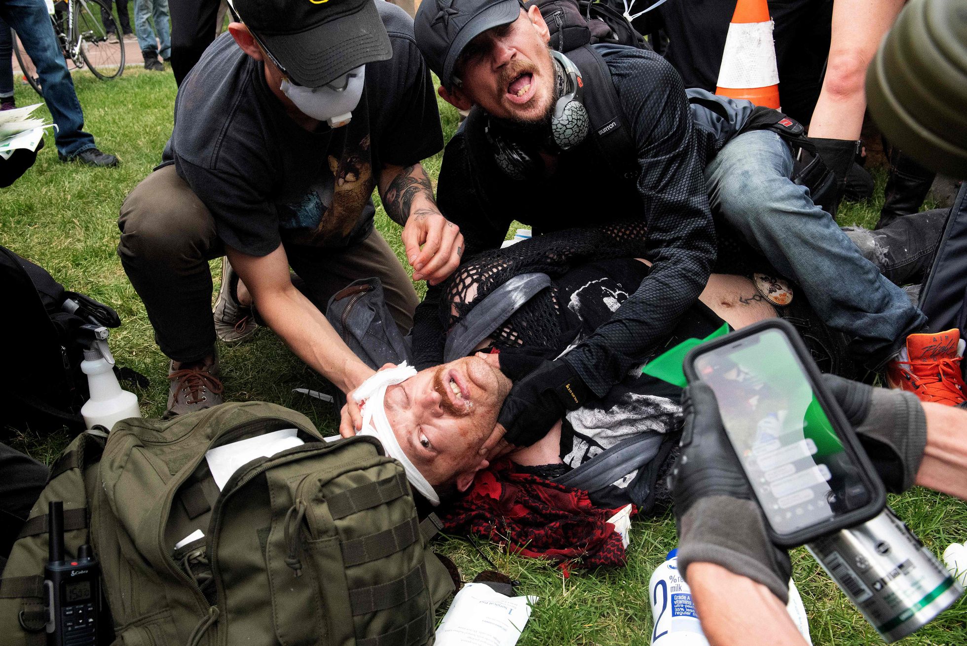Nii mõnigi politseivägivalla vastu protestija on meeleavalduste käigus saanud viga.