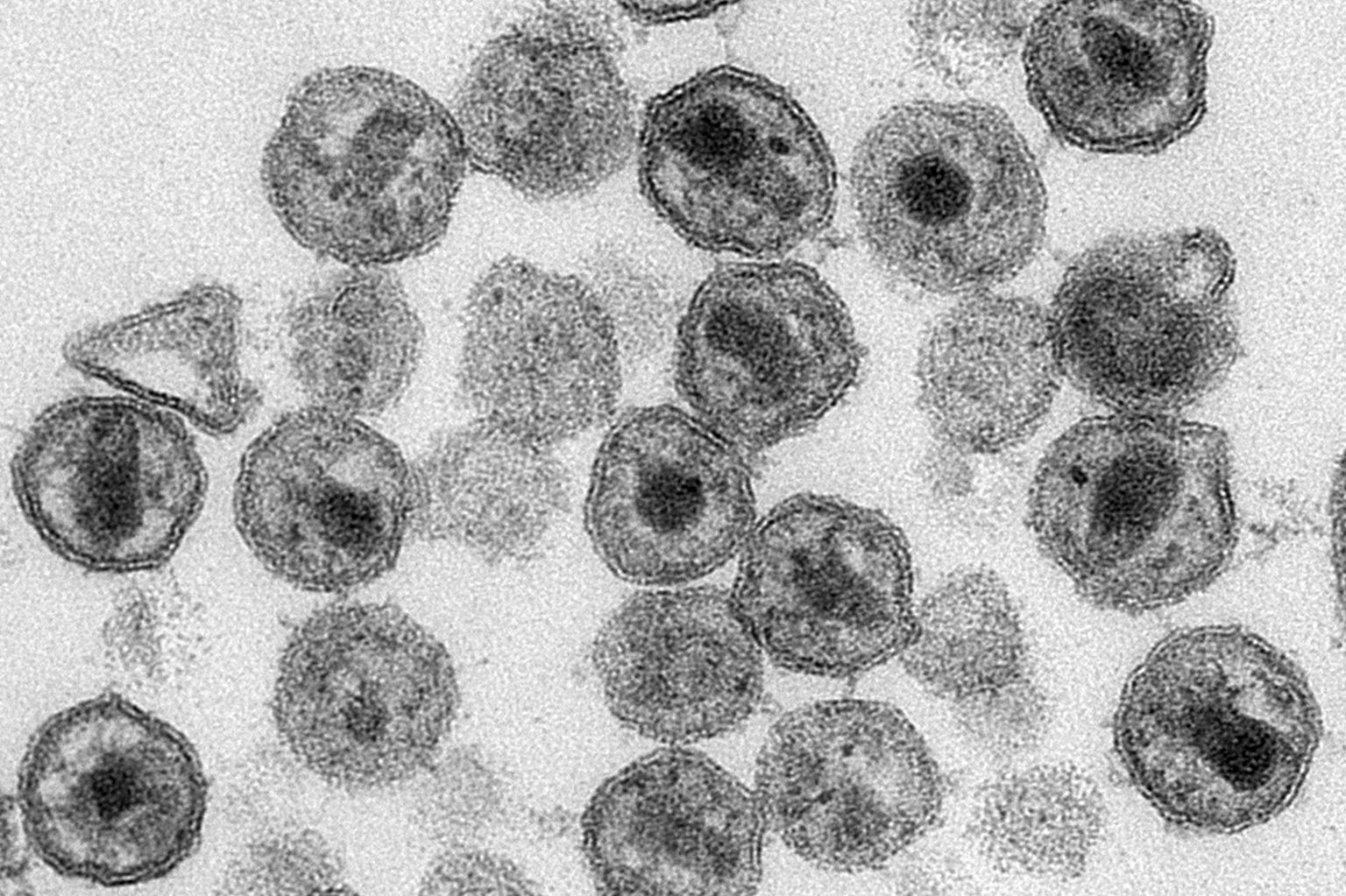 Mikroskoobipilt HI-viiruse virioonidest, Pilt on illustratiivne.