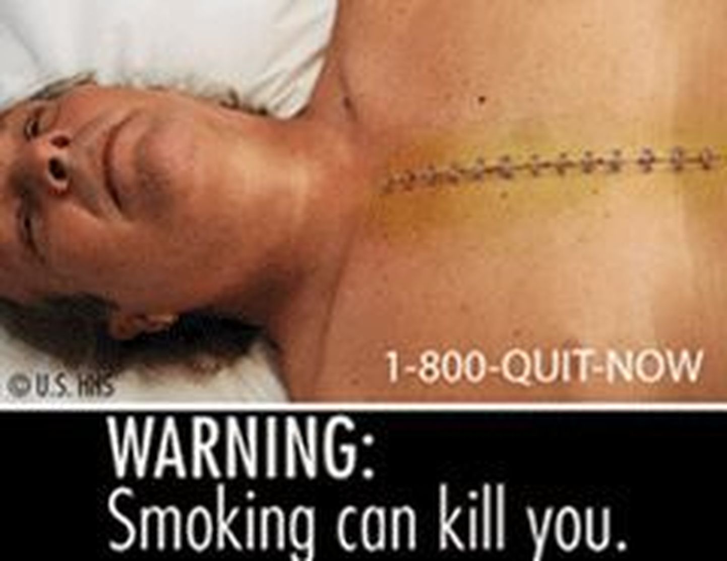 Üks üheksast pildist, mis peaks järgmise aasta septembrist ilmuma USAs müüdavatele sigaretipakkidele.