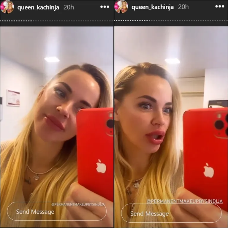 Raksta foto