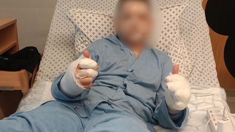 «Käis pauk, poiss oli selili ja juuksed põlesid.» Noormehe kalaretk lõppes haiglas
