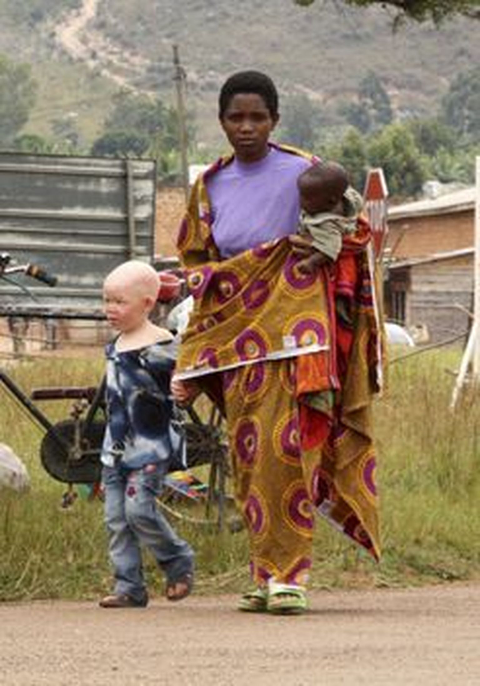 Burundi ema oma kahe lapsega, kellest üks on albiino