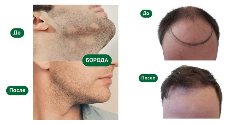Фото статьи