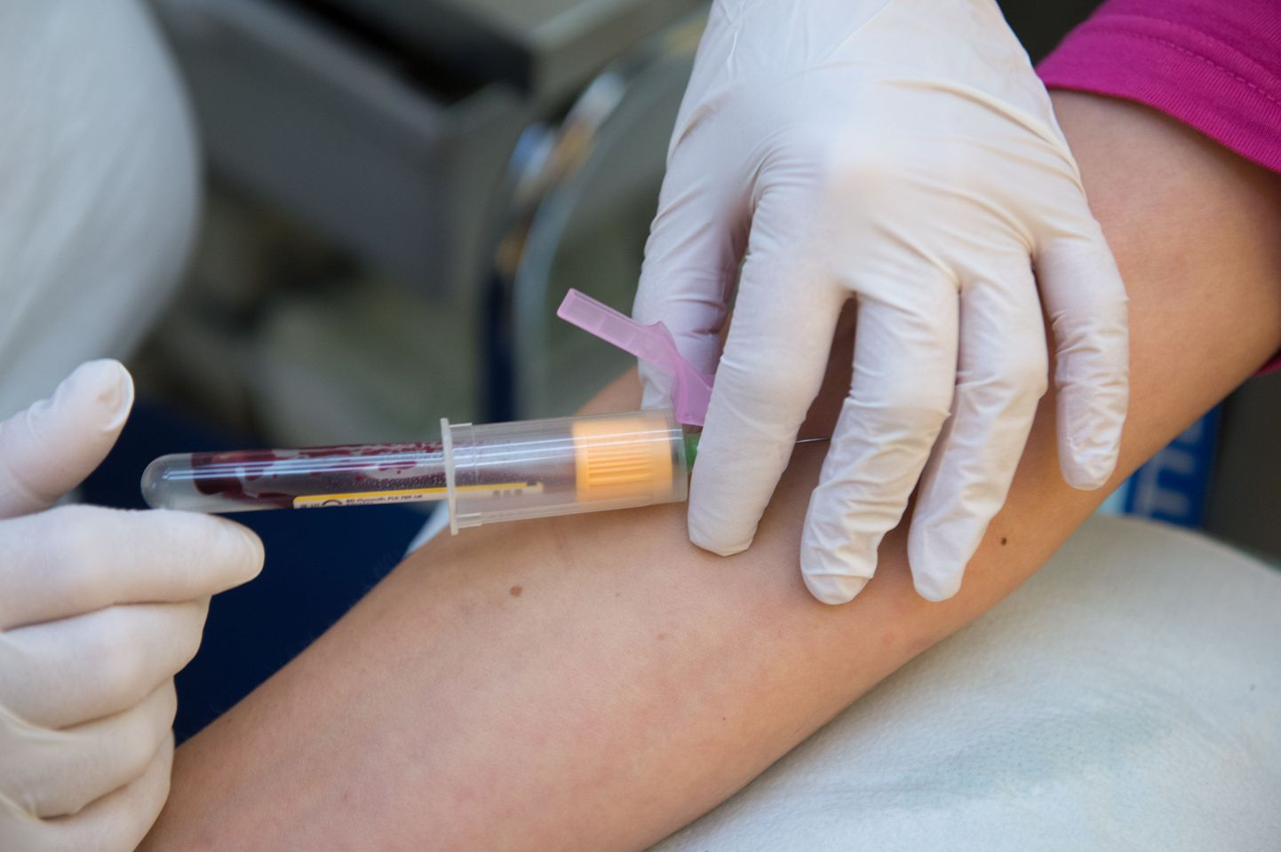 Uue veretesti abil saab tunni ajaga kindlaks teha, kas patsiendi haiguse põhjuseks on viirus või bakterid.