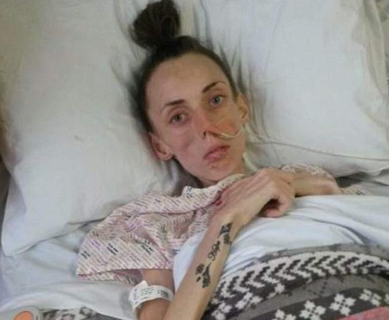 Hannah Lucas muutis söömishäire tõttu nii nõrgaks, et ei jõudnud isegi kõndida ning sattus mitu korda eluohtlikus seisus haiglasse. 