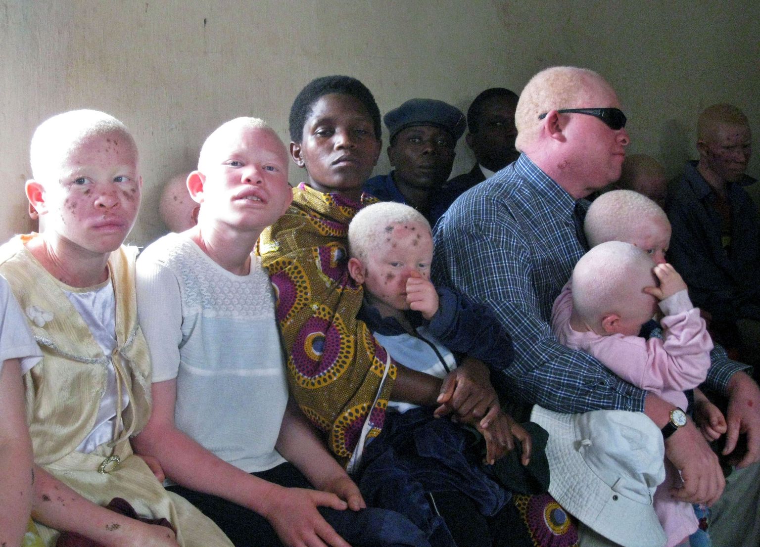 Burundi perekond, kus isa ja lapsed on albiinod
